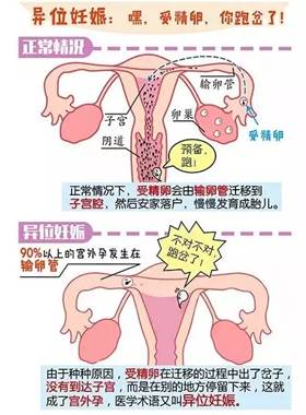 在正常情况下,受精卵会由输卵管迁移到子宫腔,然后安家落户,之后慢慢