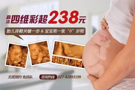 四维彩超.webp