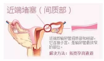 点击查看高清原图