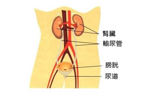 男子喝水少患一斤半結石,遍佈膀胱,腎,輸尿管_醫療合作_武漢資訊_長江